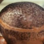 Reincarnation-birthmark